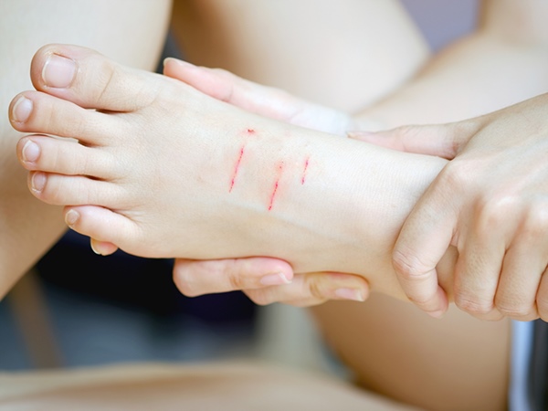 Nằm mơ thấy mèo cắn chân là điềm gì, số mấy giải xui?